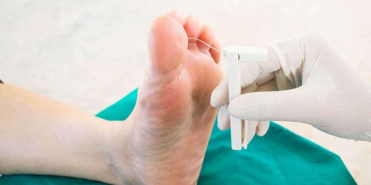 Post-Ankle Surgery Care: Tips for Faster Healing