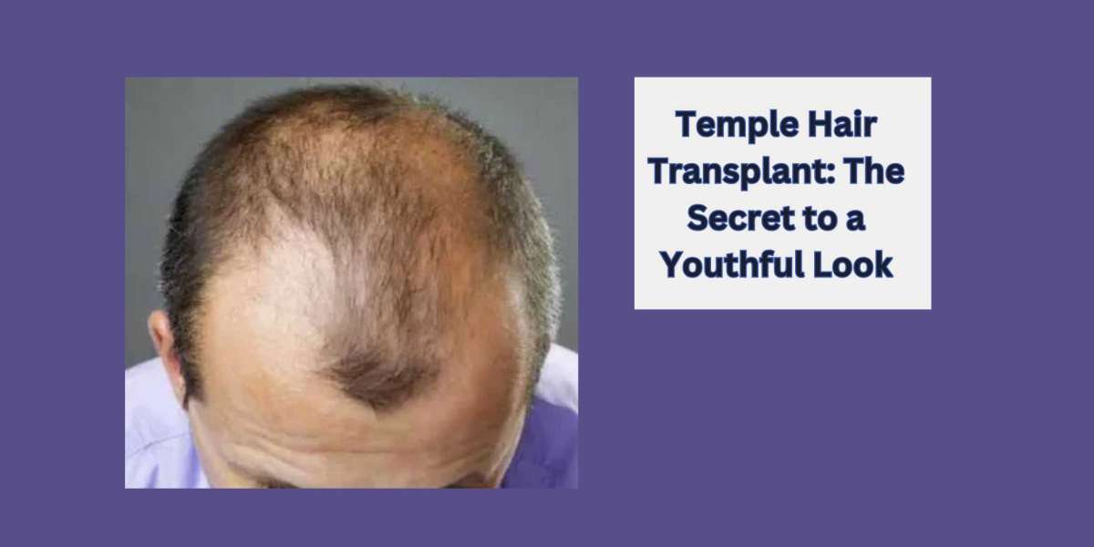 Temple Hair Transplant: The Secret to a Youthful Look