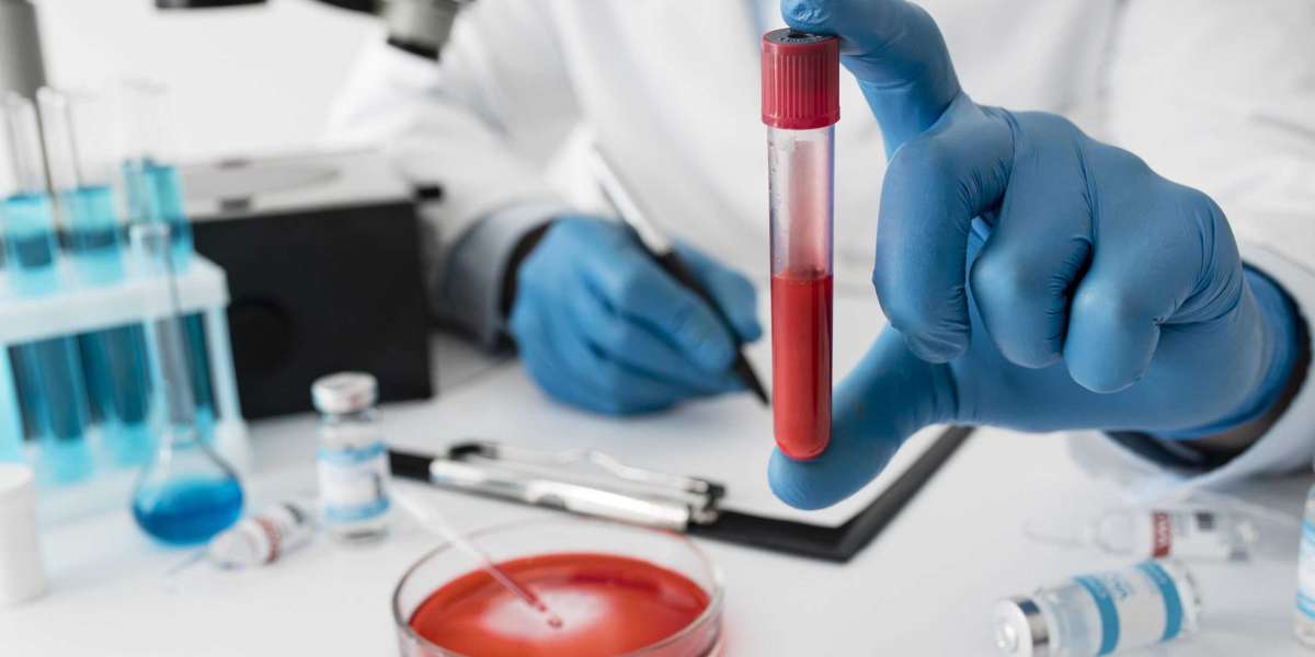 Book a Blood Test at Home Bangalore – Easy, Accurate & Affordable | EcoTown Diagnostics