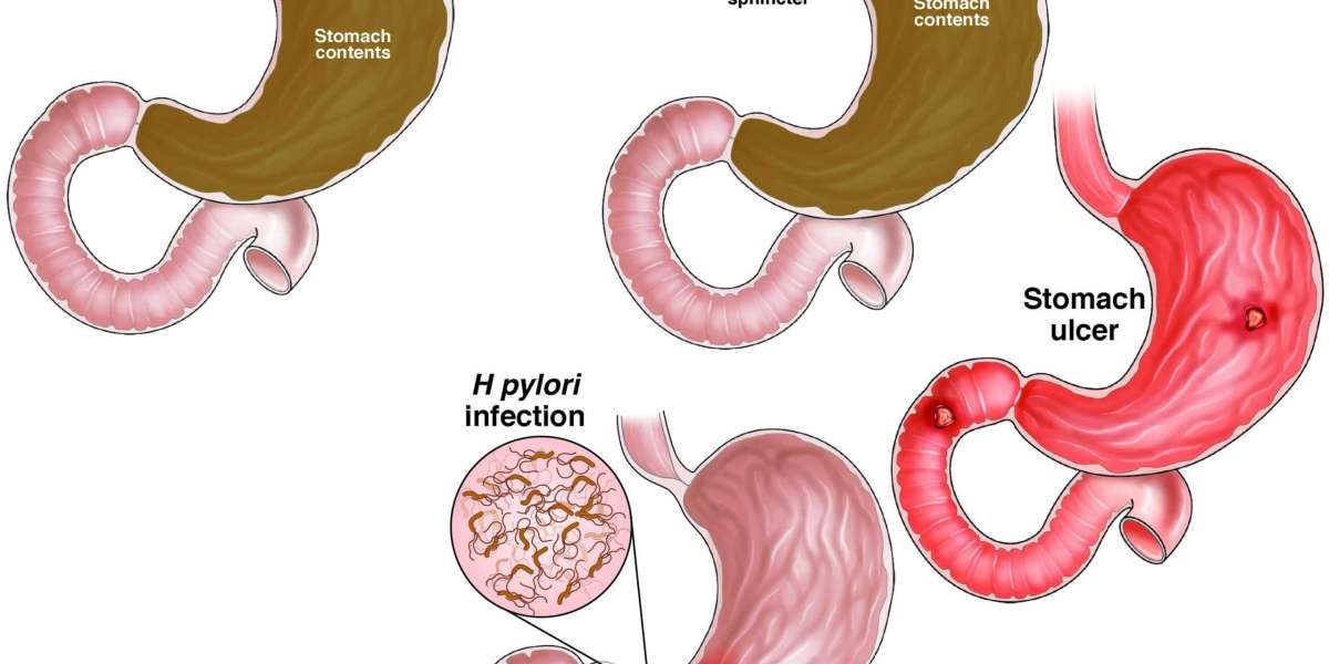 What Medications Should You Avoid with Caverta 50 mg?