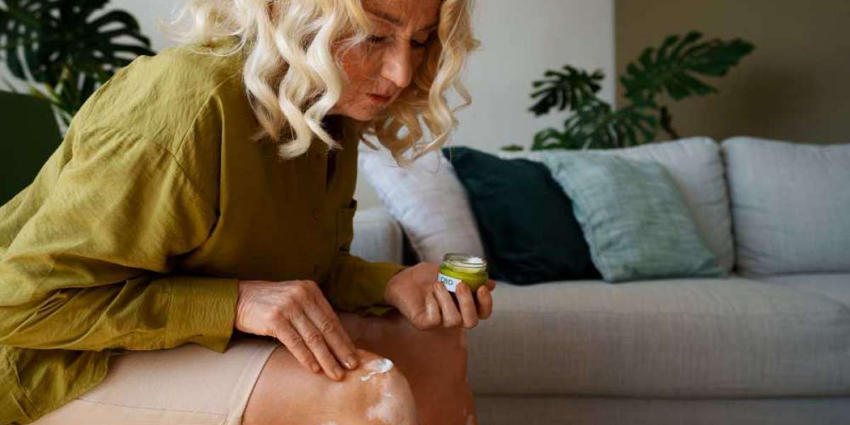 Herbal and Organic Wound Healing Products to Try