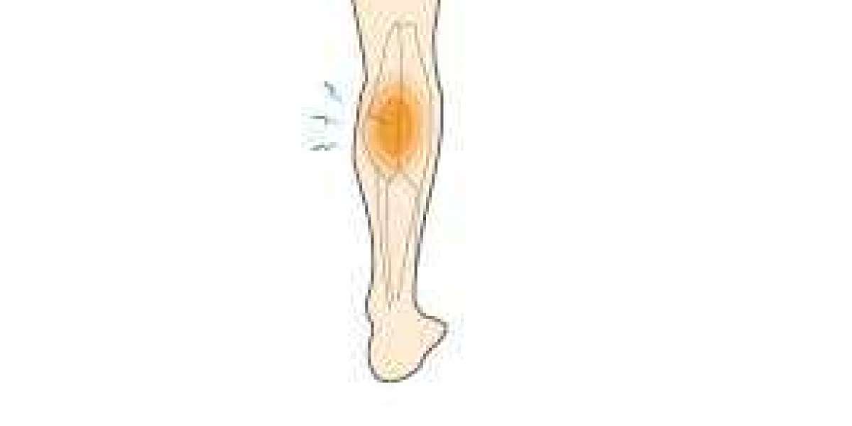 Acute Muscle Tear: Causes, Symptoms, and How to Recover Quickly