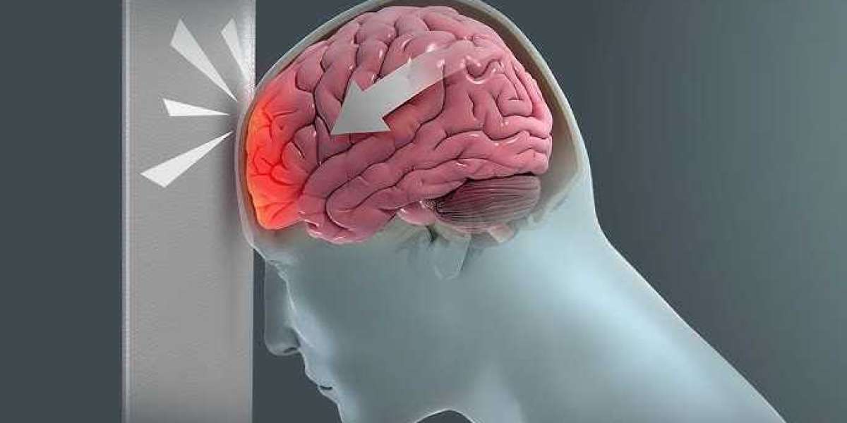 Traumatic Brain Injury (TBI): What It Is, Symptoms & Treatment