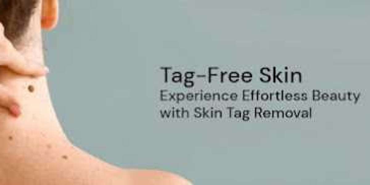 https://www.facebook.com/TagFreeSkinTagRemoverUS
