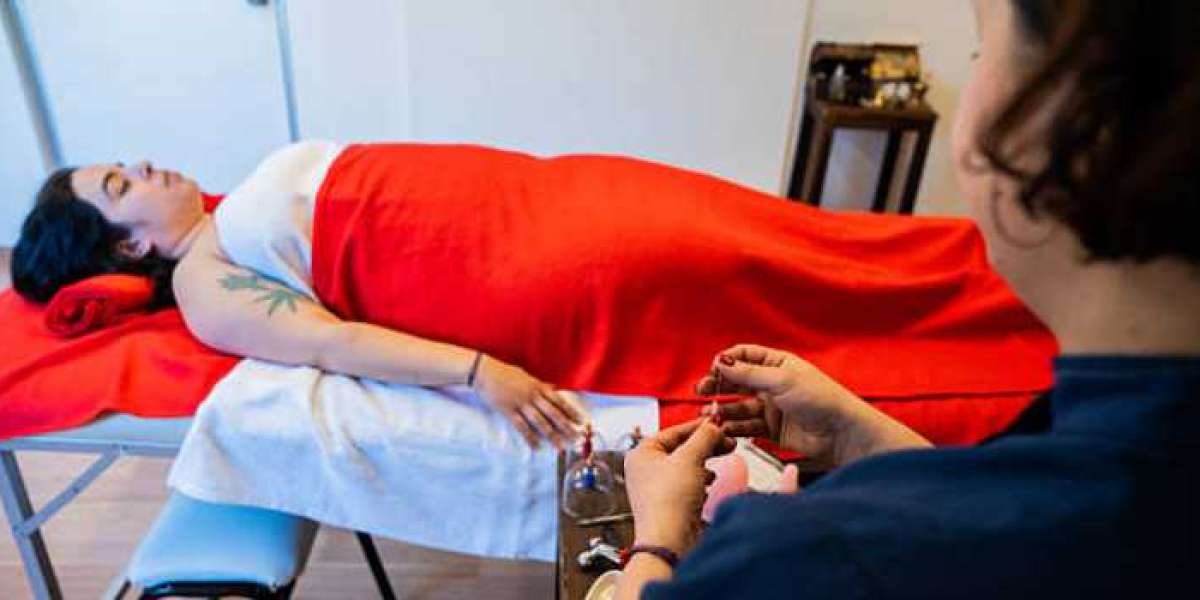 Acupuncture Near Me for Anxiety and Sleep: Therapists Who Can Help