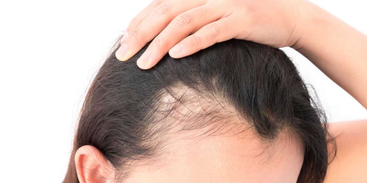 The Science Behind Hair Fall: Understanding the Causes