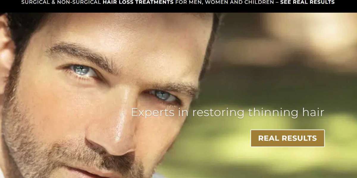 female Hair Loss and menopause