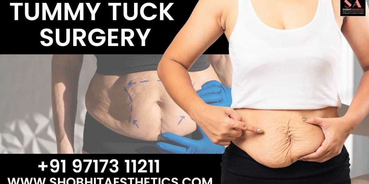 Tummy Tuck in Delhi: Is the Surgery Safe?