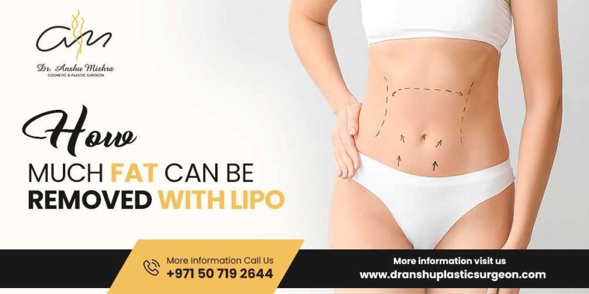 Liposuction Surgery in Dubai – Sculpting Your Ideal Shape with Expert Care by Dr. Anshu