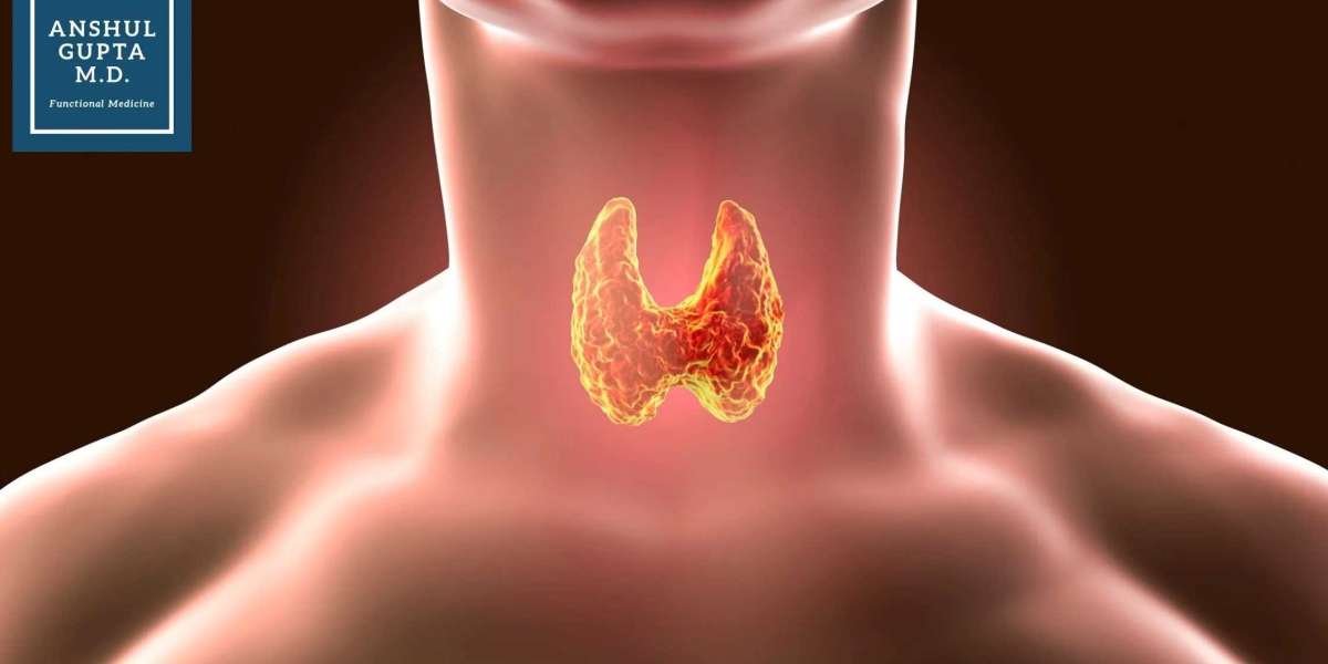 Your Guide to the Best Hashimoto’s Doctor and Thyroid Treatment Options in Los Angeles