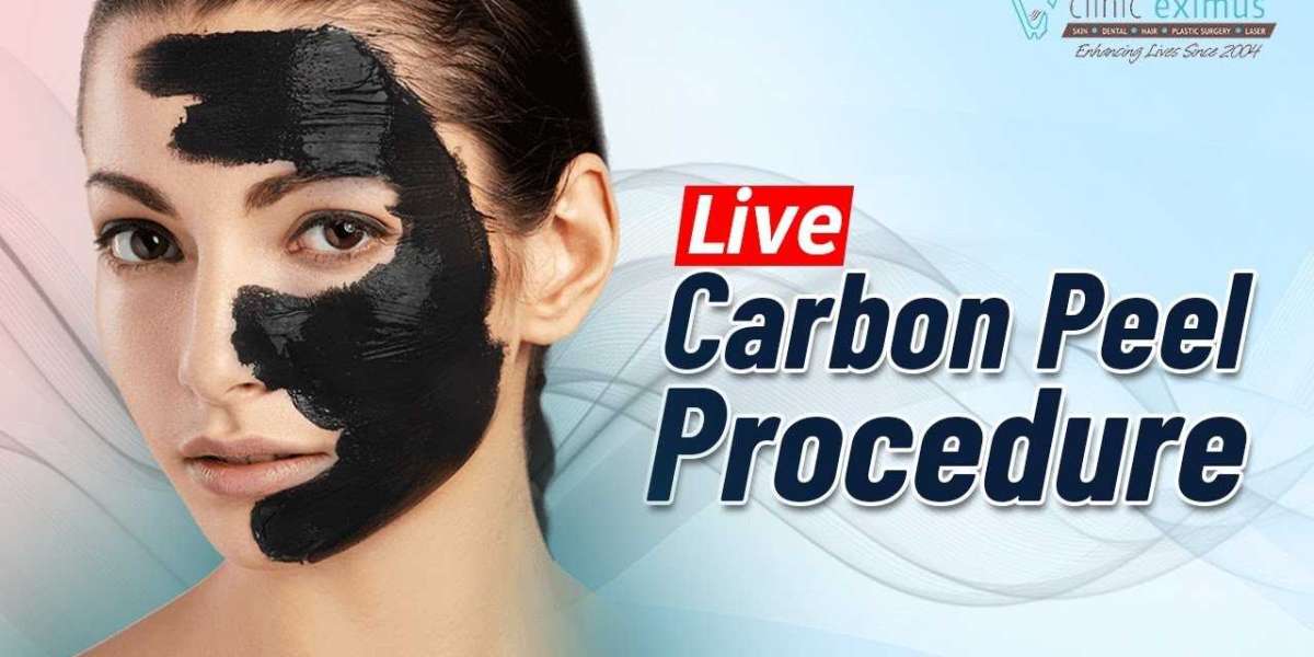 Carbon Facial Laser Treatment and Beard Shaping Treatment in Delhi at Clinic Eximus