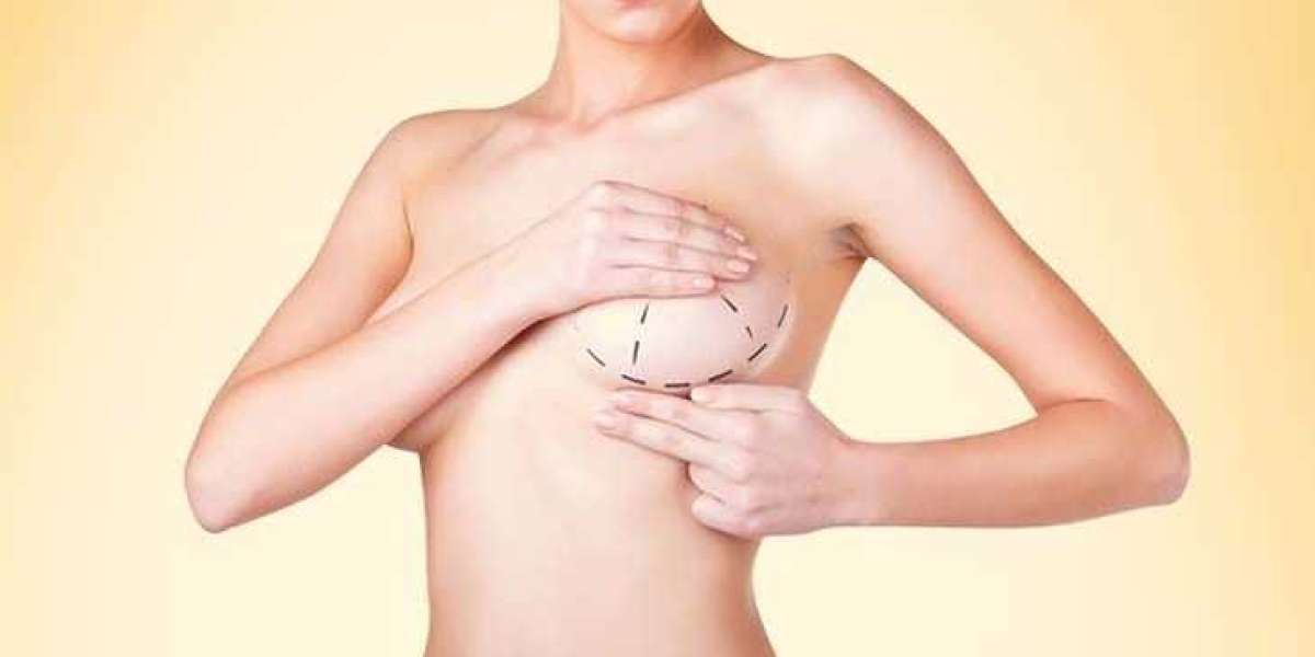 Breast Augmentation Surgery in Dubai with the Best Plastic Surgeon in Dubai – Dr. Anshu Plastic Surgeon