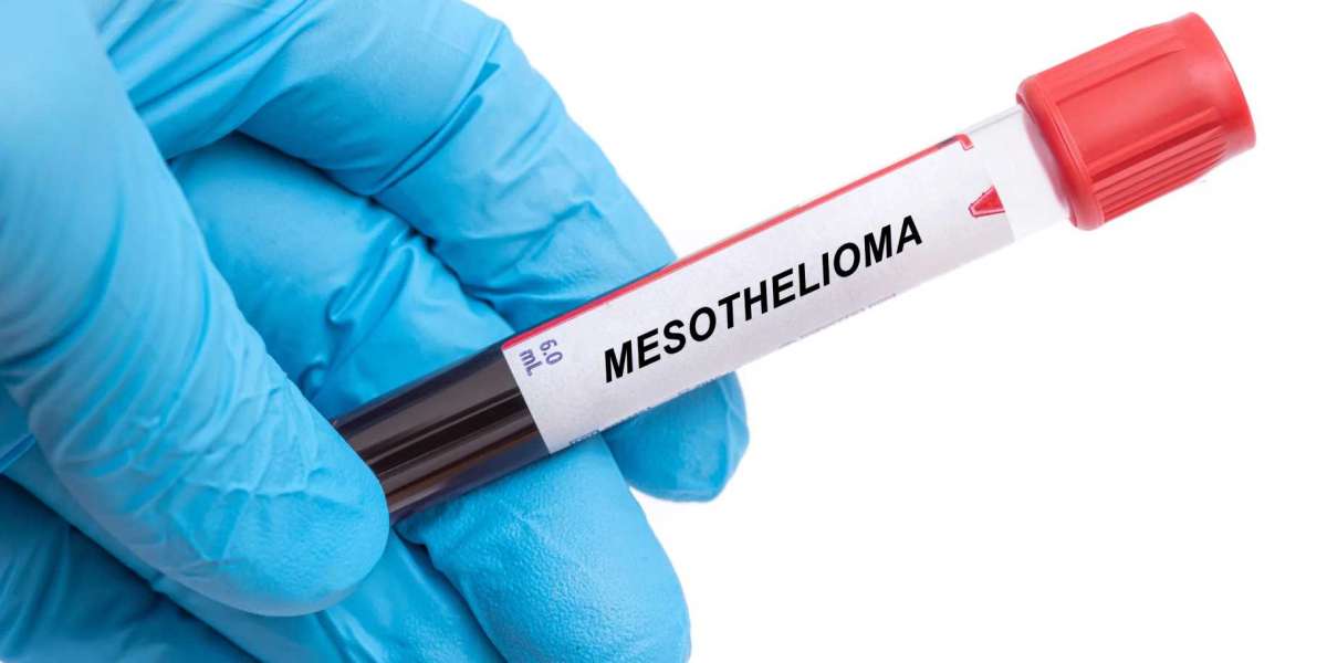 Protecting Your Rights With Experienced Mesothelioma Legal Support